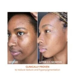 Dr Dennis Gross Alpha Beta Universal Daily Peel 12 Dr Dennis Gross Alpha Beta Universal Daily Peel -Care Products Shop Alpha Beta Universal Daily Peel add4 55577 3617 general