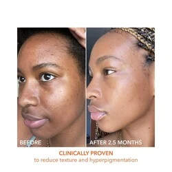 Dr Dennis Gross Alpha Beta Universal Daily Peel 7 Dr Dennis Gross Alpha Beta Universal Daily Peel - Image 5