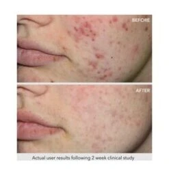 QuasarMD Clear Rayz - White -Care Products Shop Clear Rayz White add3 34621 3948 general