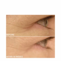 Dr Dennis Gross DRx SpectraLite EyeCare Max Pro -Care Products Shop DRx SpectraLite EyeCare Max Pro add11 55581 8703 general