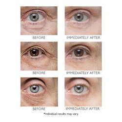 Peter Thomas Roth Instant FirmX Eye 4 Peter Thomas Roth Instant FirmX Eye - Image 2