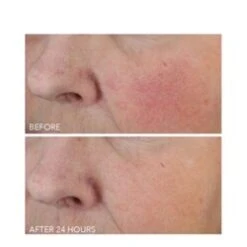 Dr Dennis Gross Vitamin C + Lactic Dewy Deep Cream 9 Dr Dennis Gross Vitamin C + Lactic Dewy Deep Cream -Care Products Shop Vitamin C Lactic Dewy Deep Cream add3 68793 6217 general